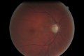 Fundus Photo 2