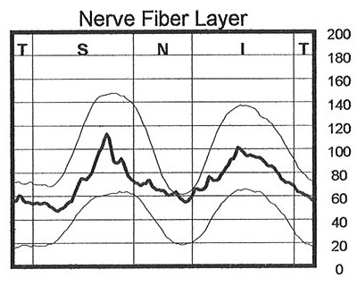 GDx.NFL.Right.2004.09.08