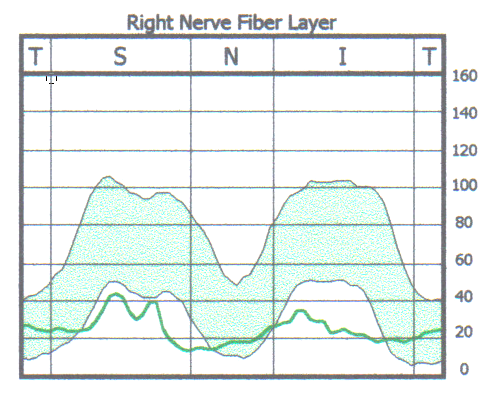 GDx.NFL.Right.2006.12.14