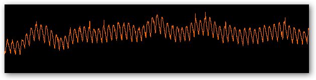 77 seconds of intraocular pressure measurements