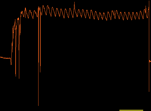 Ocular Pulse Wave