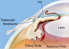 Glaucoma