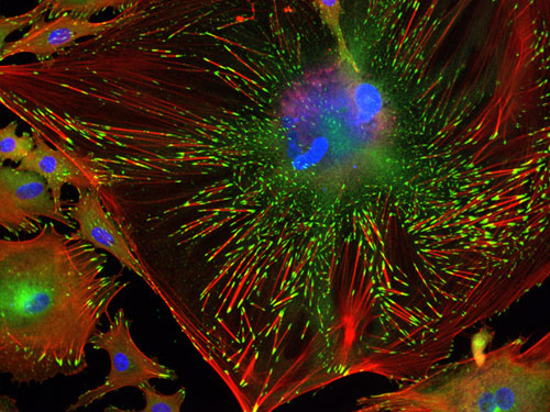 Trabecular Meshwork Cell (detail)