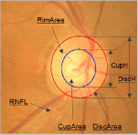 Fundus cup disk